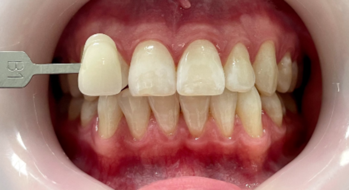 After - Londent Dental