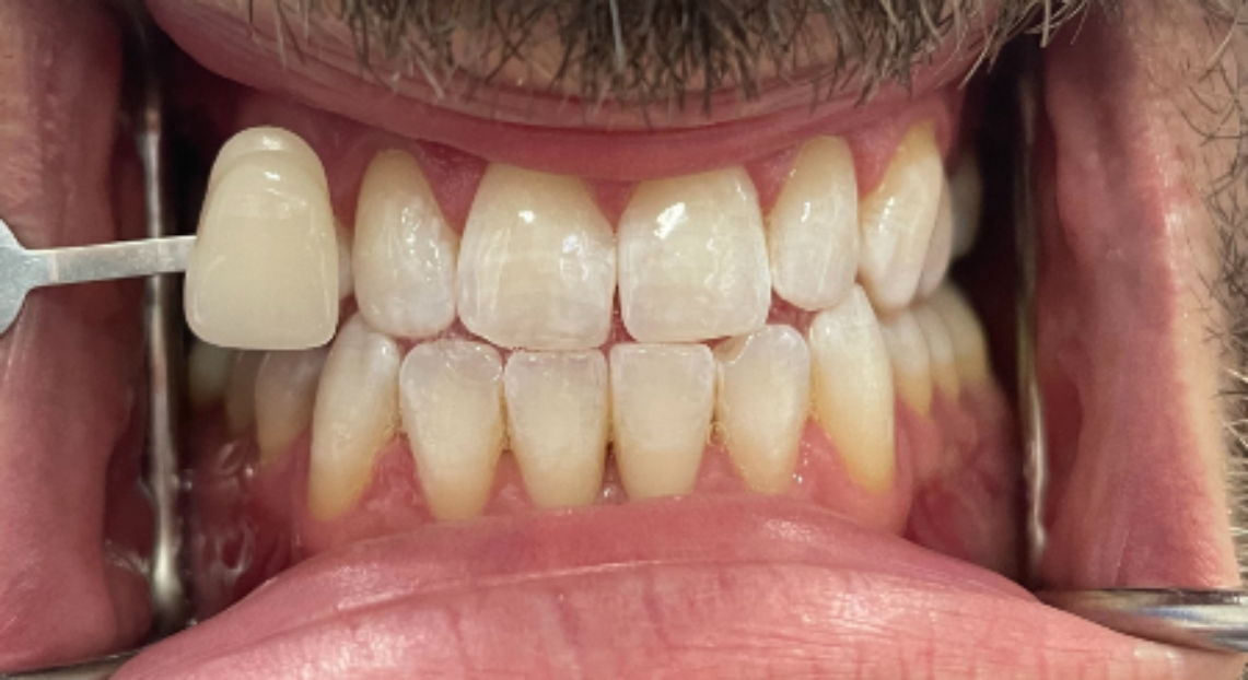 After - Londent Dental