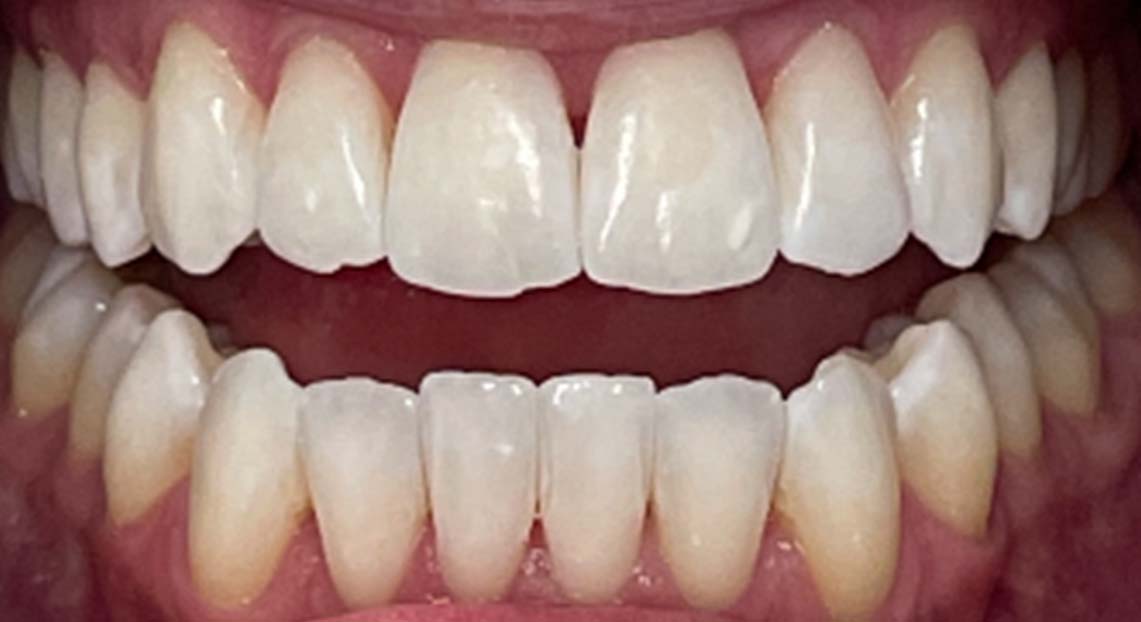 After - Londent Dental