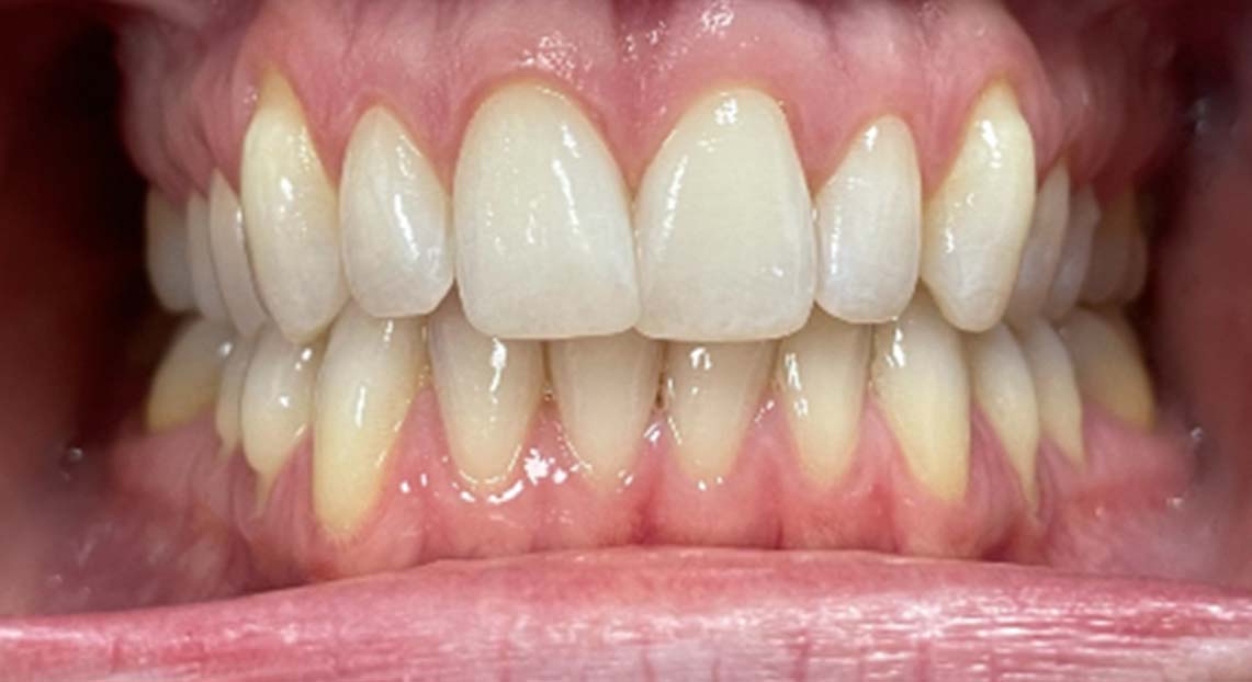 After - Londent Dental