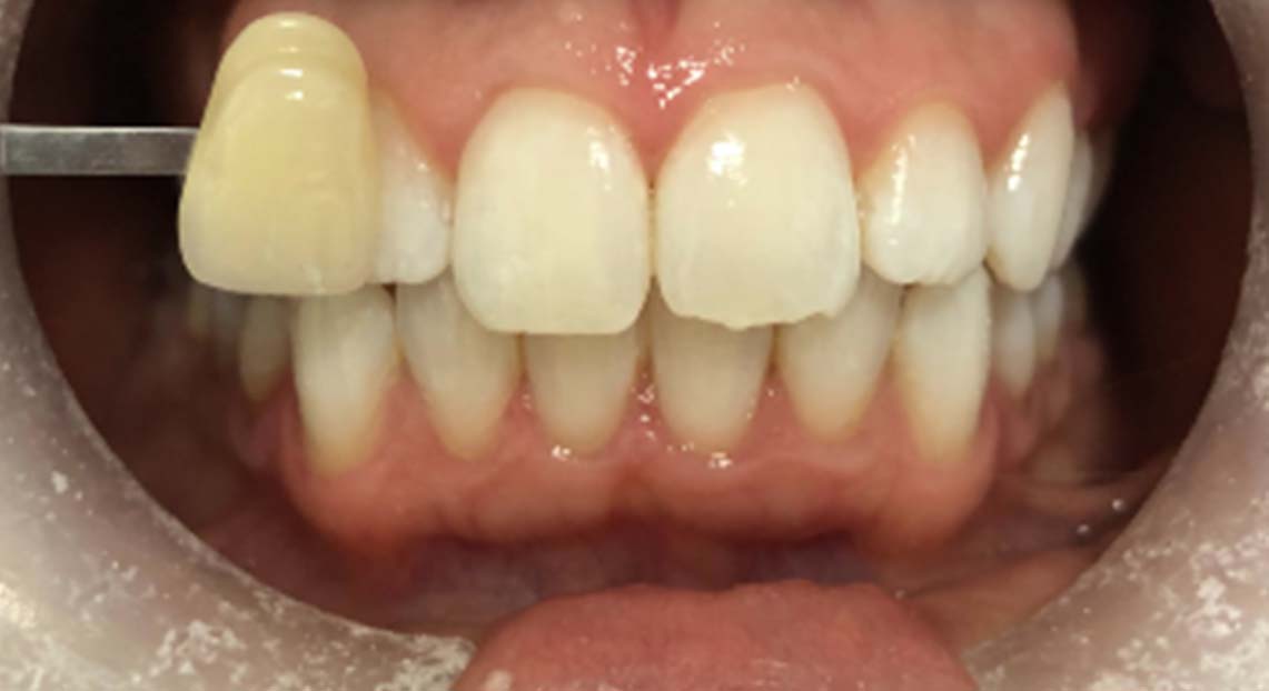 After - Londent Dental