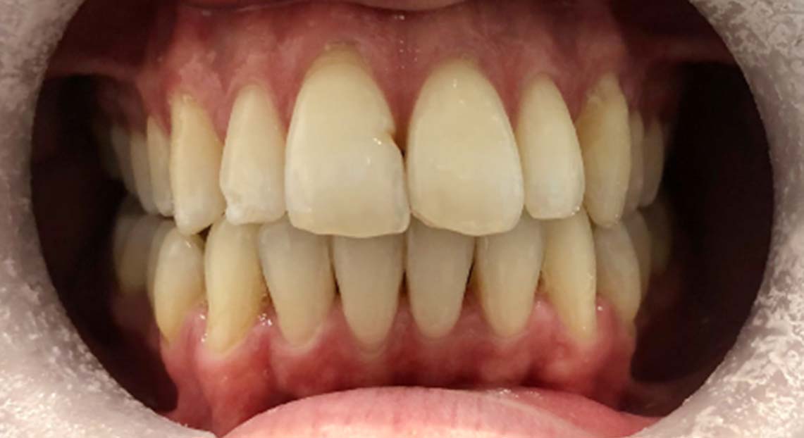 After - Londent Dental