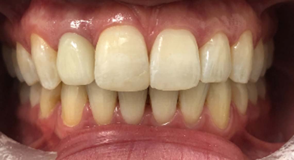 After - Londent Dental