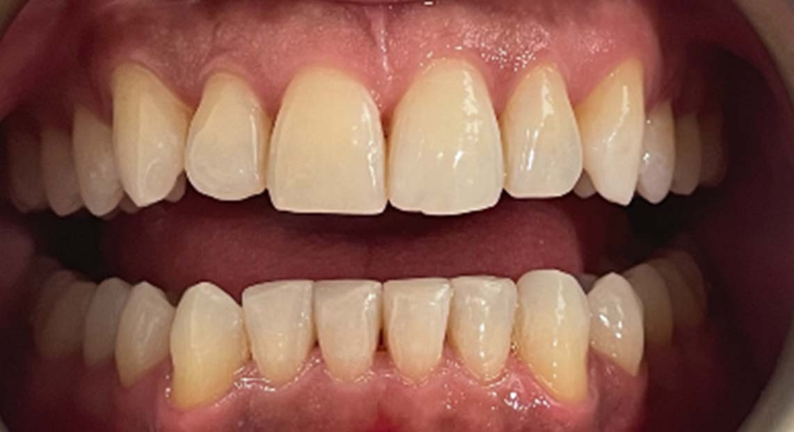 After - Londent Dental