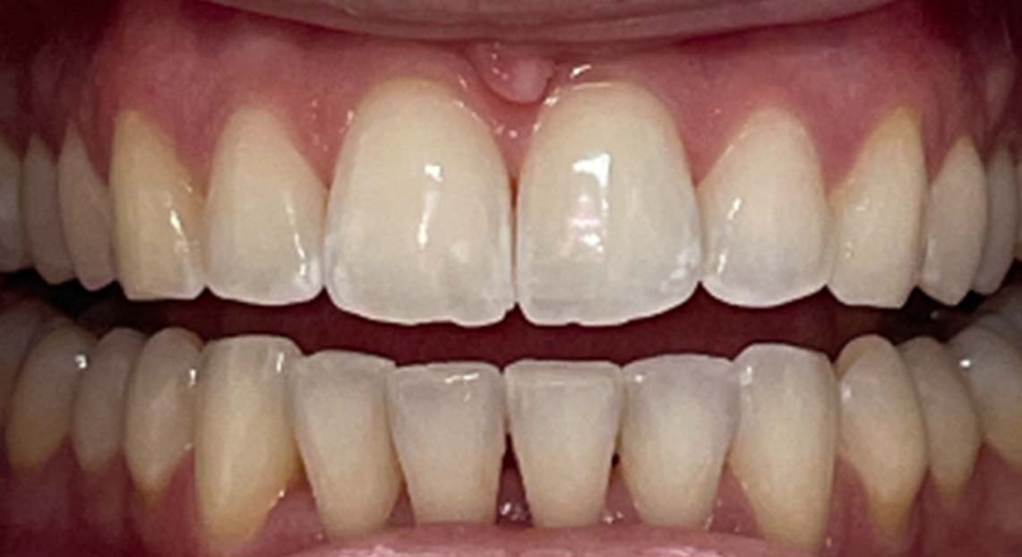 After - Londent Dental