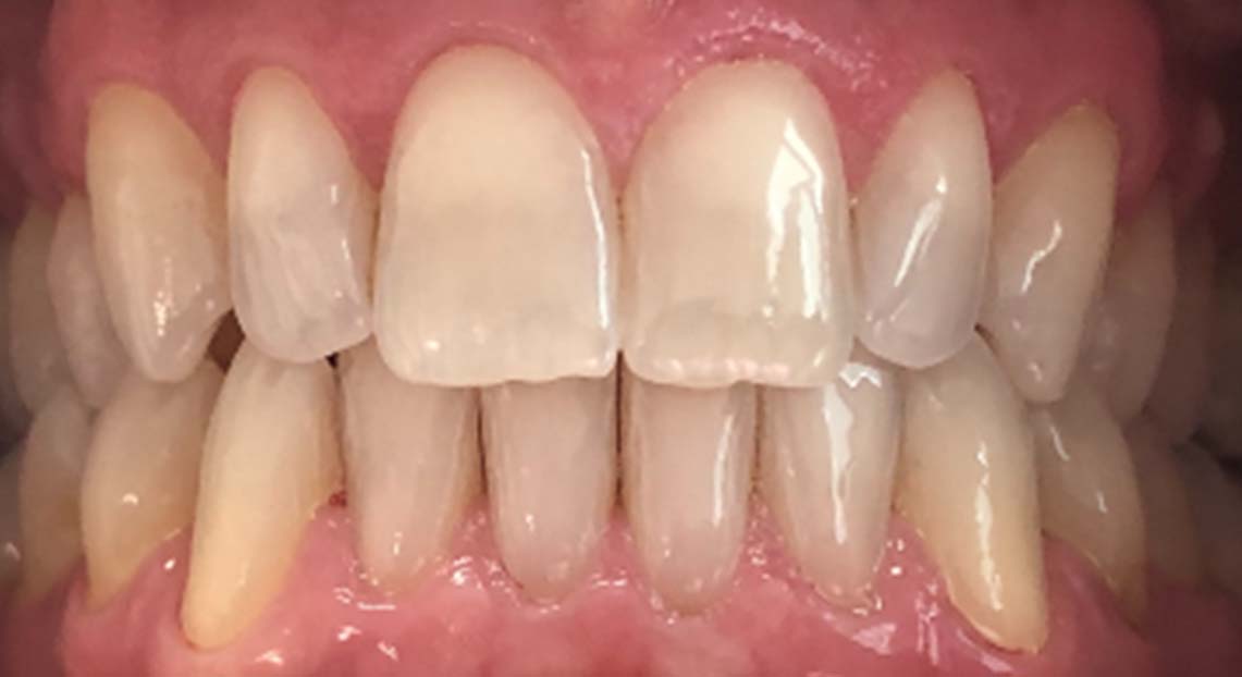 After - Londent Dental